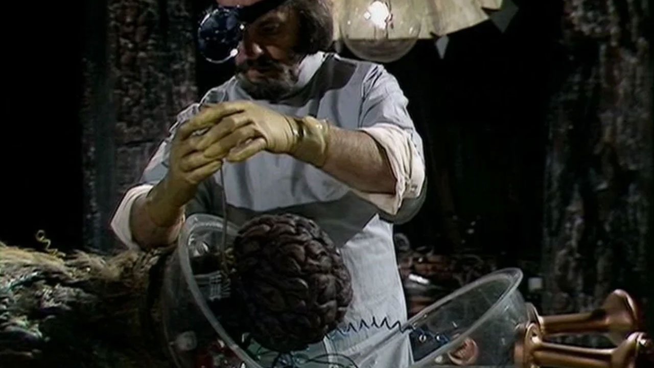 frankenstein-solon-conducts-brain-surgery-brain-of-morbius-doctor-who-back-when